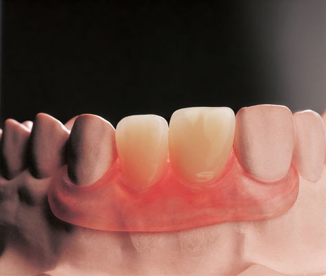 ซื้อ ฟันเทียมยืดหยุ่น Flipper ถอนออก ฟันเทียมยืดหยุ่น online manufacture