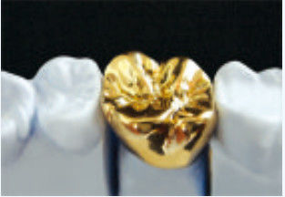 ซื้อ สีเหลืองโลหะมงกุฎและสะพาน สะพานมงกุฎสกัดจากสแตนเลส online manufacture