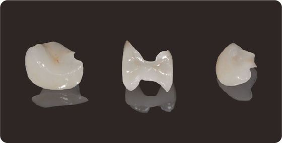 ซื้อ ความแม่นยําของฟัน Inlays และ Onlays Lithium Disilicate Milling Onlay วีเนียร์ online manufacture
