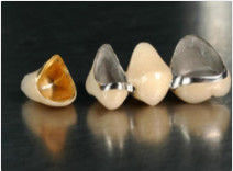 ซื้อ มงกุฎสแตนเลสอันมีค่า และมงกุฎชั่วคราวสีเหลือง online manufacture