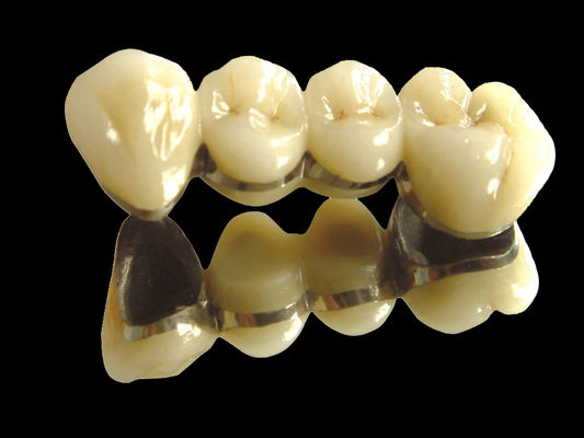ซื้อ สะพานโลหะอันมีค่า สะพานมงกุฎ สะพานสวมกันทนต่อการสวมใส่ online manufacture