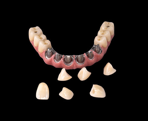 ซื้อ ALL ON X Implant Titanium สะพาน โครงสร้างฟันเฉพาะมืออาชีพ online manufacture