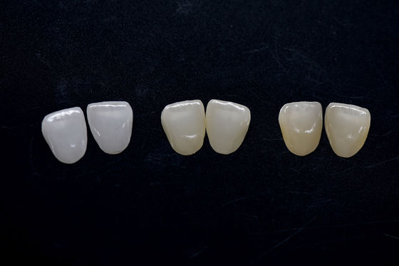 ซื้อ สวยงามสูง เซอร์โคเนีย วีเนียร์ ยาวนาน เซอร์โคเนีย อีแมกซ์ วีเนียร์s online manufacture
