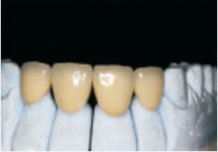 ซื้อ สีขาว สายสลัดอันมีค่า สีสูง และสะพาน ถูกต้องและตามสั่ง online manufacture