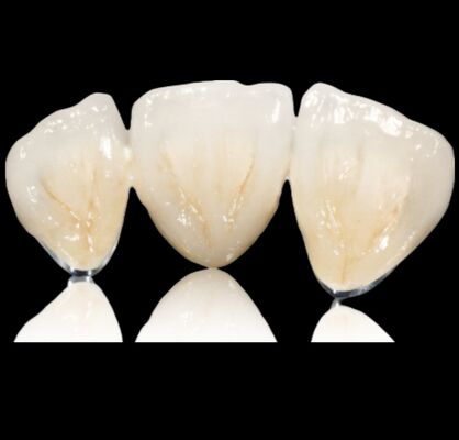 ซื้อ สามารถปรับแต่งครึ่งมงกุฎหรือสะพานมงกุฎและสะพาน online manufacture