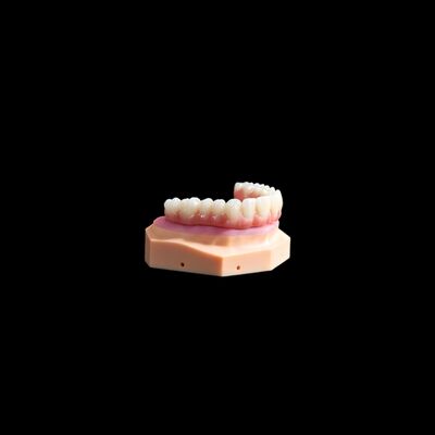 ซื้อ ALL ON X จังหวะการปลูกทิตาเนียม สะพานฟันด้วยคอมพอสิตแม่นยํา online manufacture