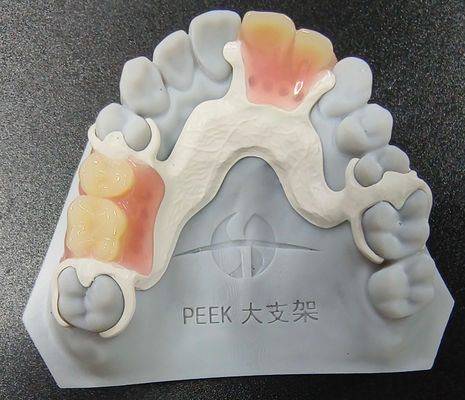 ปรับปรุง Peek ปรับปรุงฟันเทียมถอนได้