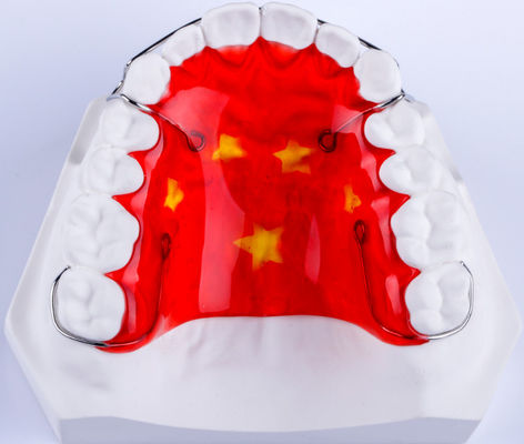 สะสมสตางค์สปริงถอนได้ Hawley Retainer หลังจาก Invisalign
