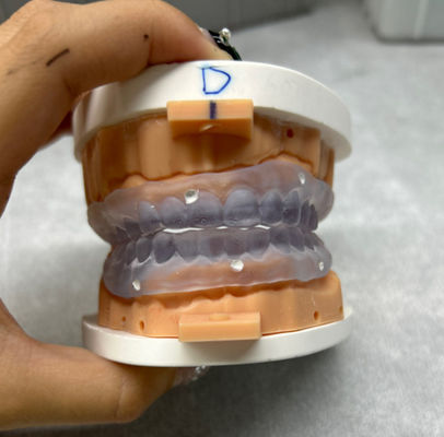 ฟันเทียมพิมพ์แบบ 3D ที่สามารถปรับเปลี่ยนได้ ลองฟันเทียมเต็มแบบดิจิตอล