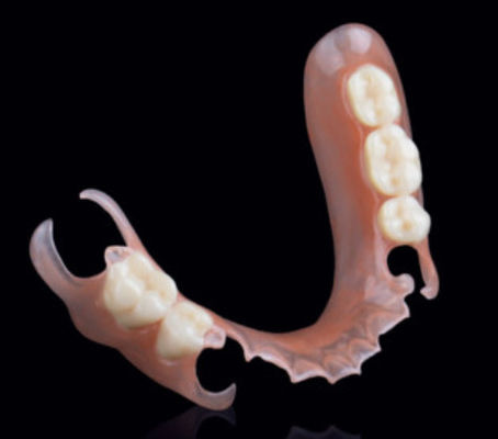 Valplast ฟักฟันยืดหยุ่นถอดได้บางส่วน การติดตั้งความแม่นยําในฟันขัด