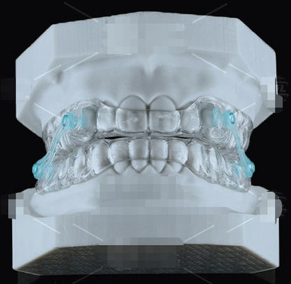 Erkodent Transparent Silensor อุปกรณ์ ทันตกรรมจัดฟันs ป้องกันการหงุดหงิด