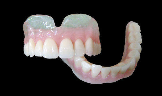 Vertex Clear Partial Overdenture โปรเทสติกส่วนถอนได้
