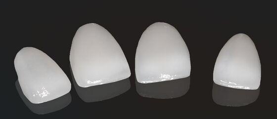 ความสวยงามสูง ประกอบพระราชทาน Onlay วีเนียร์ ขนาดที่สามารถปรับแต่งได้